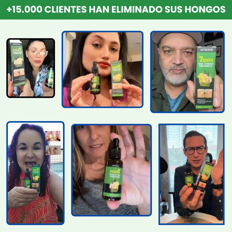 Tratamento Natural Contra Fungos – 7 Dias de Resultados Comprovados! ¡Compra 1 y obtenga 2 HOY!