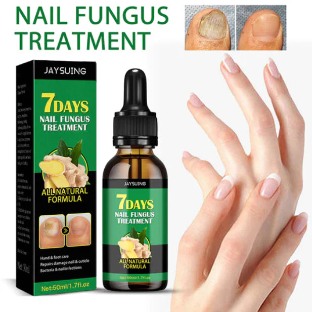 Tratamento Natural Contra Fungos – 7 Dias de Resultados Comprovados! ¡Compra 1 y obtenga 2 HOY!