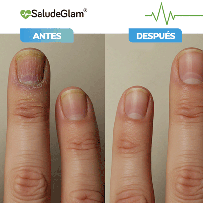 Purenail Terapia Avanzada!